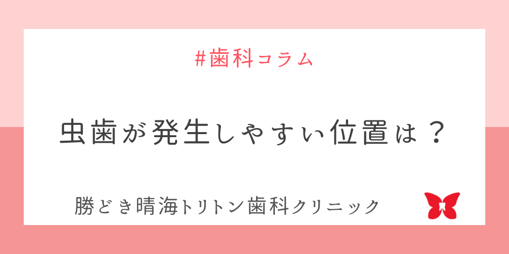 虫歯が発生しやすい位置とは？